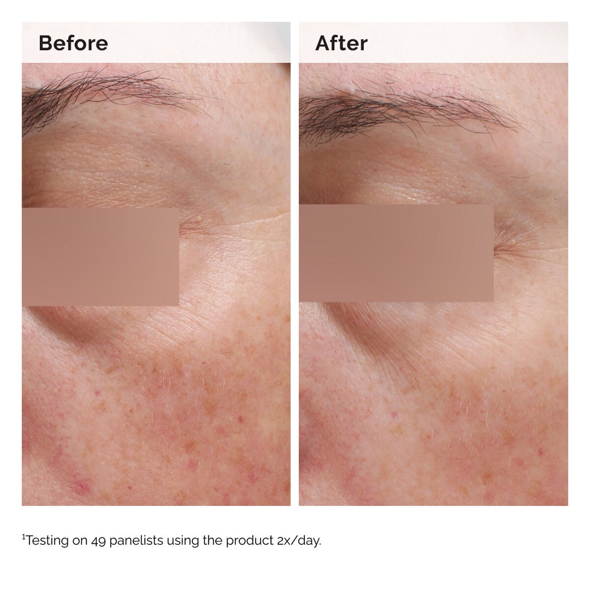 niacinamide-5-face-and-body-emulsion-s9 2024-08-23-ORD-Nia-5pct-Face-Body-B-A-Elasticity-Global-02-1x1.jpg