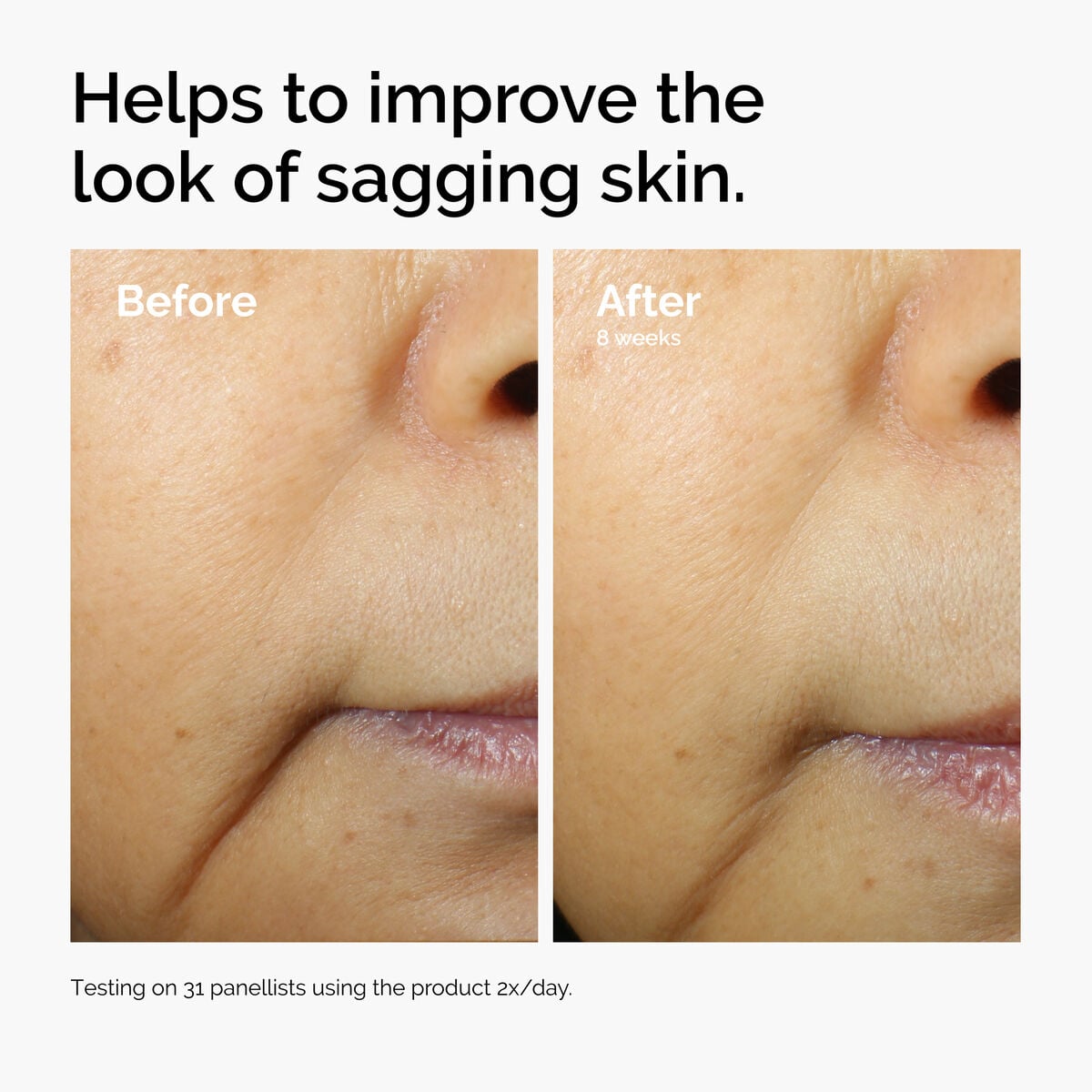 caffeine-3-escin-1-face-serum-m9 ord-caffeine-3pct-escin-1pct-face-serum-before-after-sagging.jpg