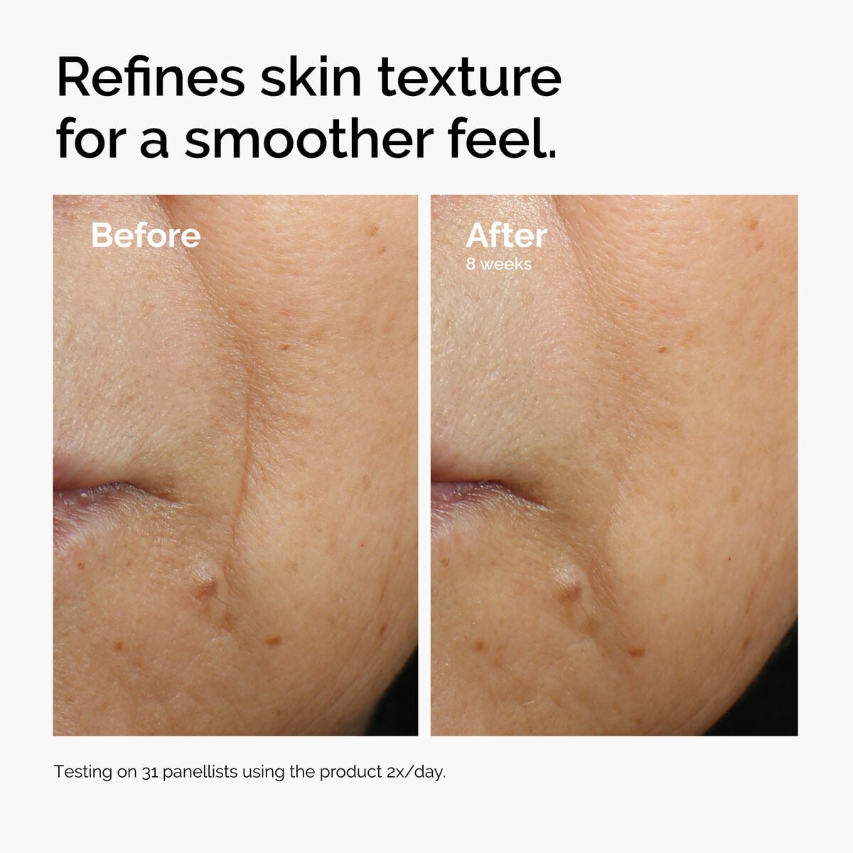 caffeine-3-escin-1-face-serum-m9 ord-caffeine-3pct-escin-1pct-face-serum-before-after-texture.jpg