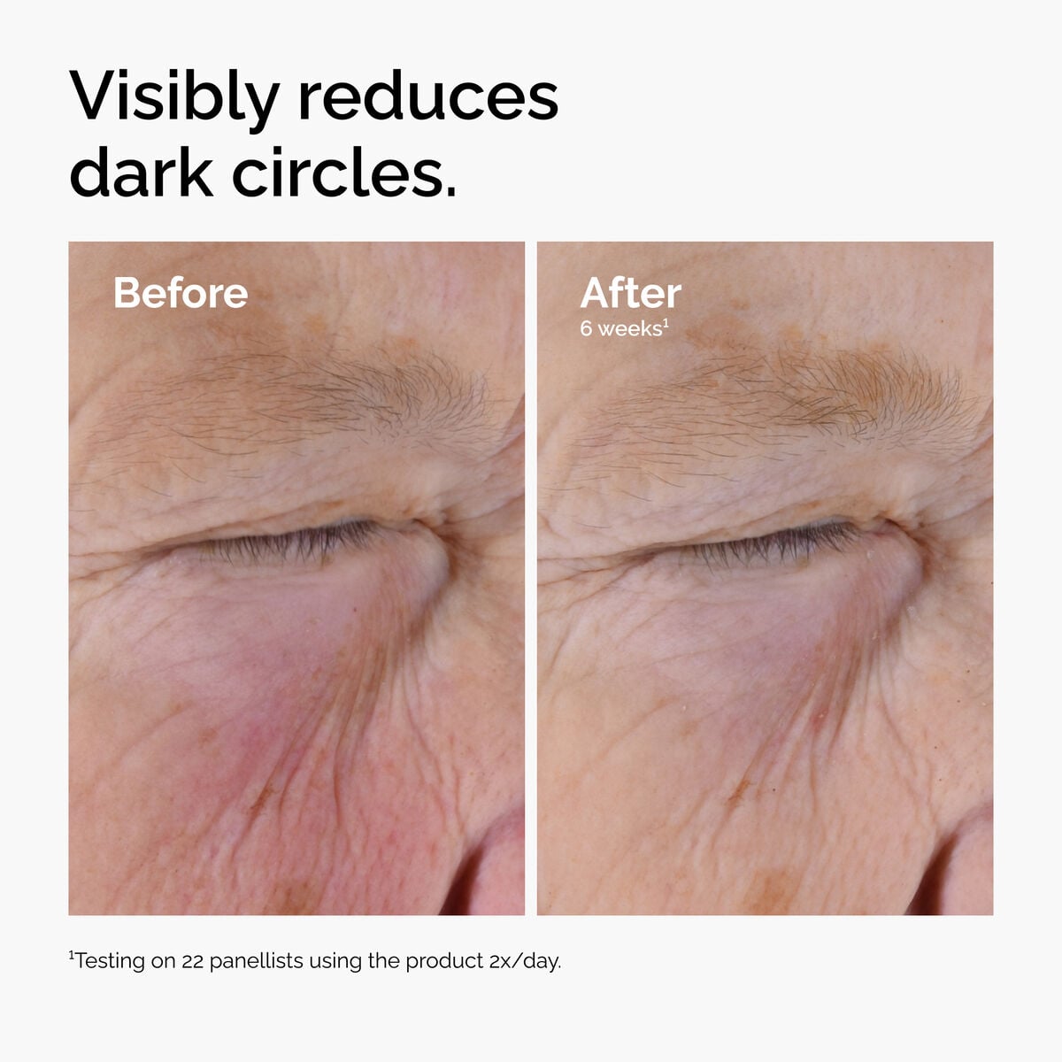 caffeine-solution-5-egcg-eye-serum-n8 ord-caffeine-solution-egcg-dark-circles-before-after.jpg