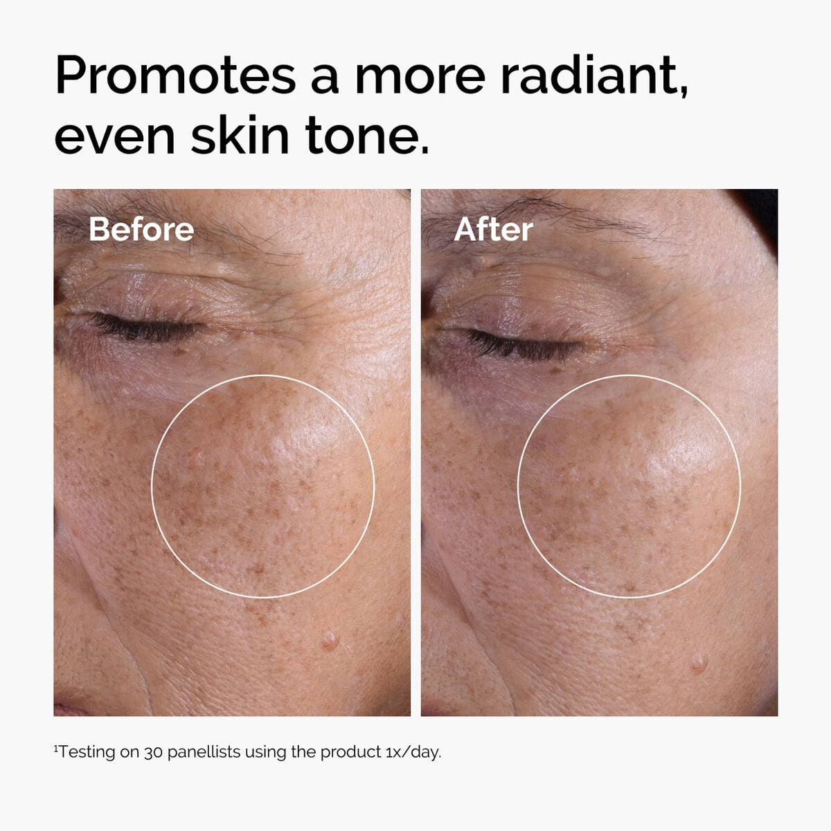 glycolic-acid-7-exfoliating-toner-l0 ord-glycolic-before-after-radiance.jpg
