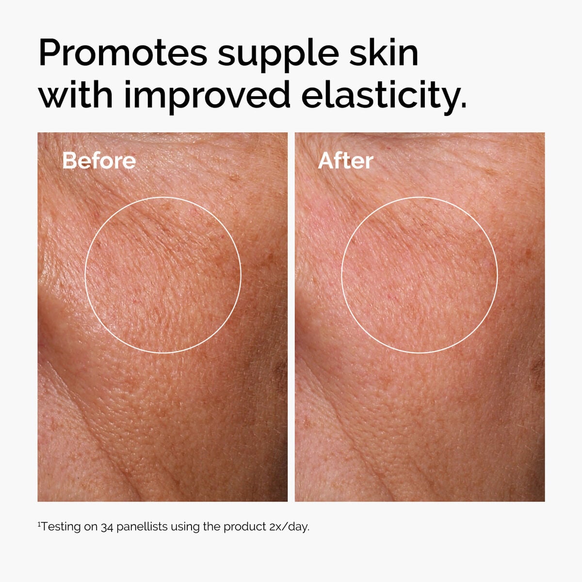 hyaluronic-acid-2-b5-with-ceramides-o7 ord-hyaluronic-acid-2pct-b5-hydrating-serum-before-after-elasticity.jpg