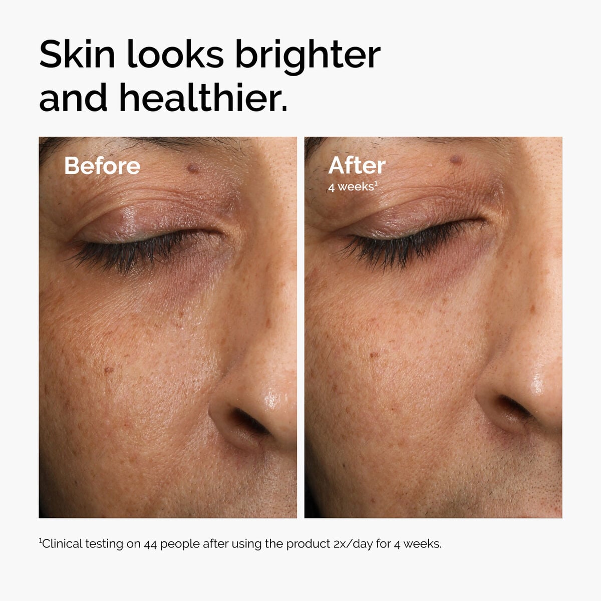 multi-antioxidant-radiance-serum-d3 ord-mars-before-after-healthy.jpg