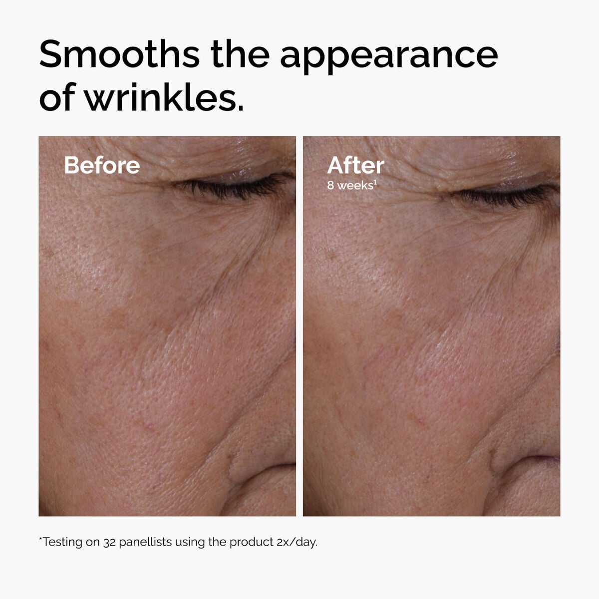 multi-peptide-ha-serum-r7 ord-multi-peptide-ha-serum-wrinkles-before-after.jpg