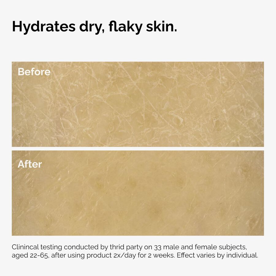 the-body-care-collection-g5 ord-natural-moisturizing-factors-inulin-body-before-after-graphic-02.jpg