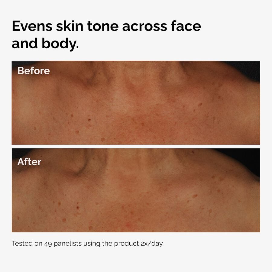 the-body-care-collection-g5 ord-niacinamide-face-body-serum-before-after-even-tone-graphic.jpg