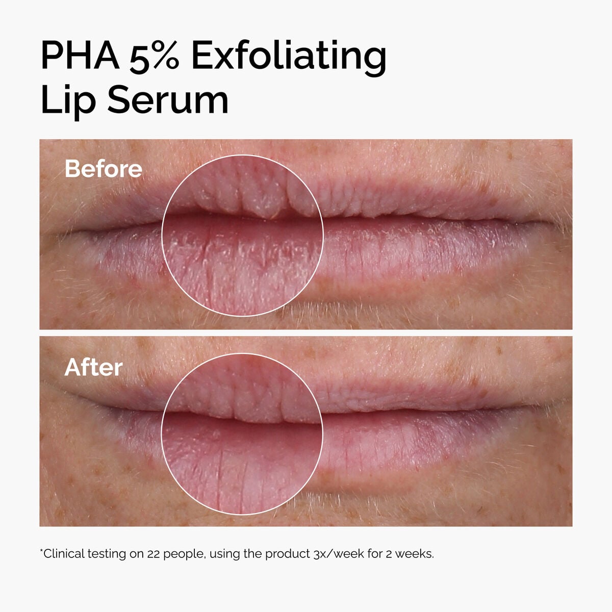 pha-5-exfoliating-lip-serum-j3 ord-pha-5pct-lip-exfoliating-serum-before-after.jpg