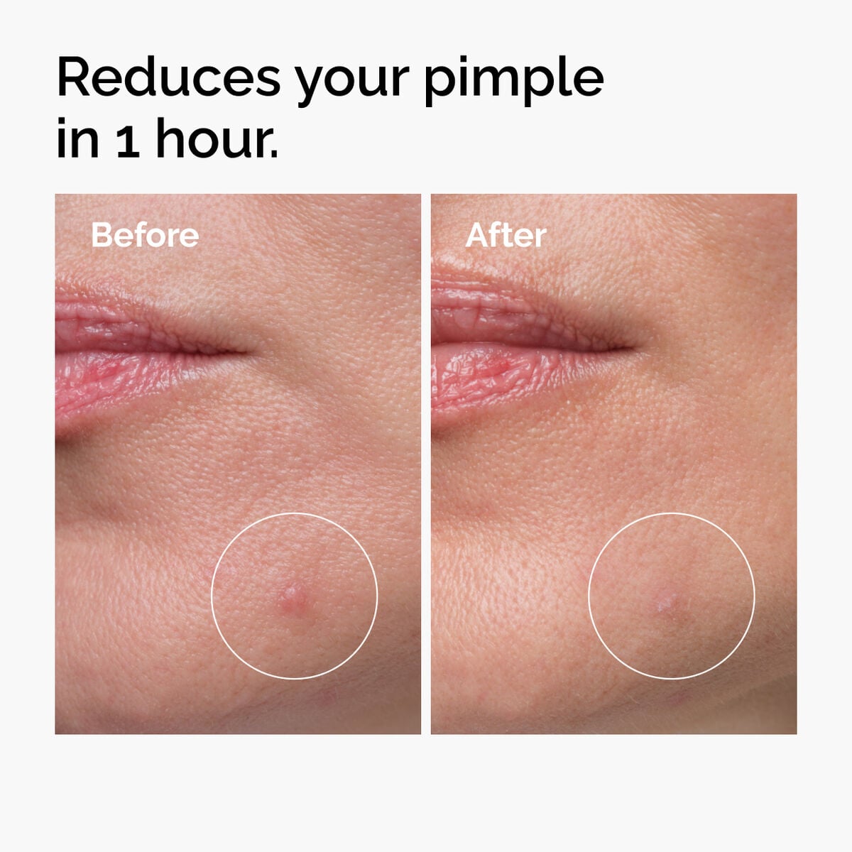 sulfur-10-powder-to-cream-concentrate-d4 ord-sulfur-10pct-powder-to-cream-concentrate-before-after-NA.jpg