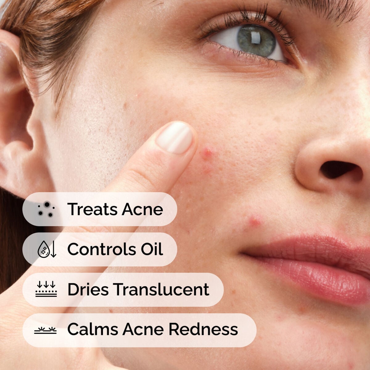sulfur-10-powder-to-cream-concentrate-d4 ord-sulfur-10pct-powder-to-cream-concentrate-model-application-with-benefits-acne.jpg